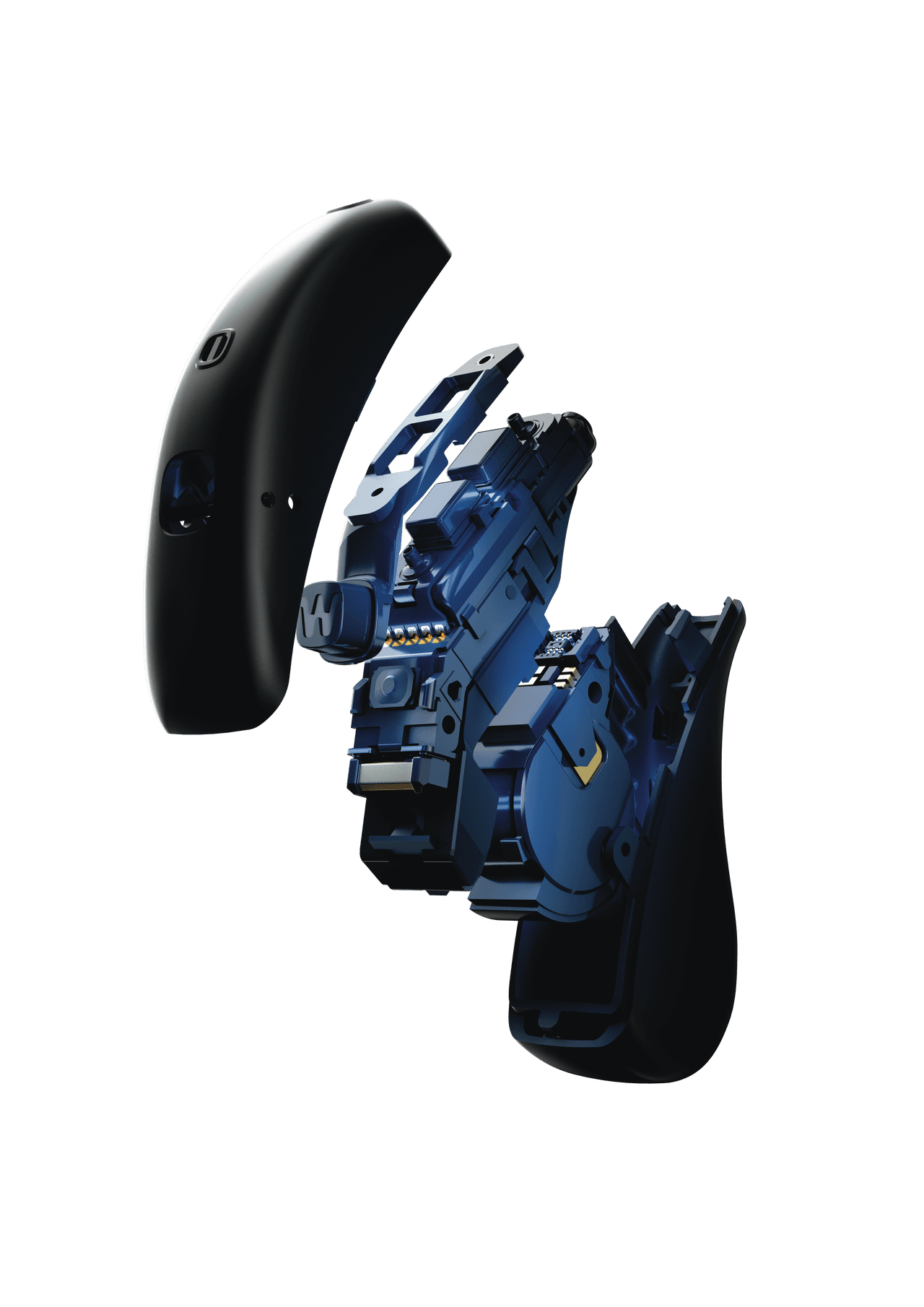 Modern İşitme Cihazlarında Teknolojik Yenilikler